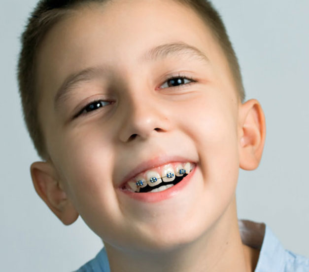 San Leandro Orthodontist